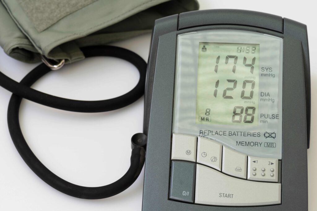 Blood pressure gauge displaying a 174 over 120