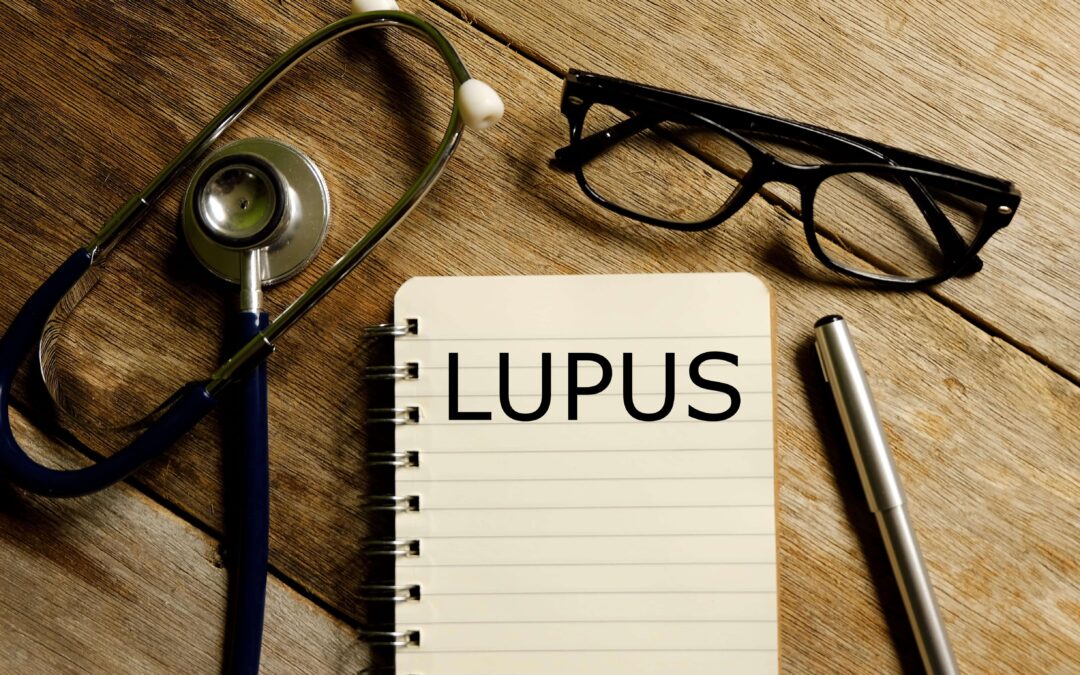 Lupus written on a notepad and glasses on a desk