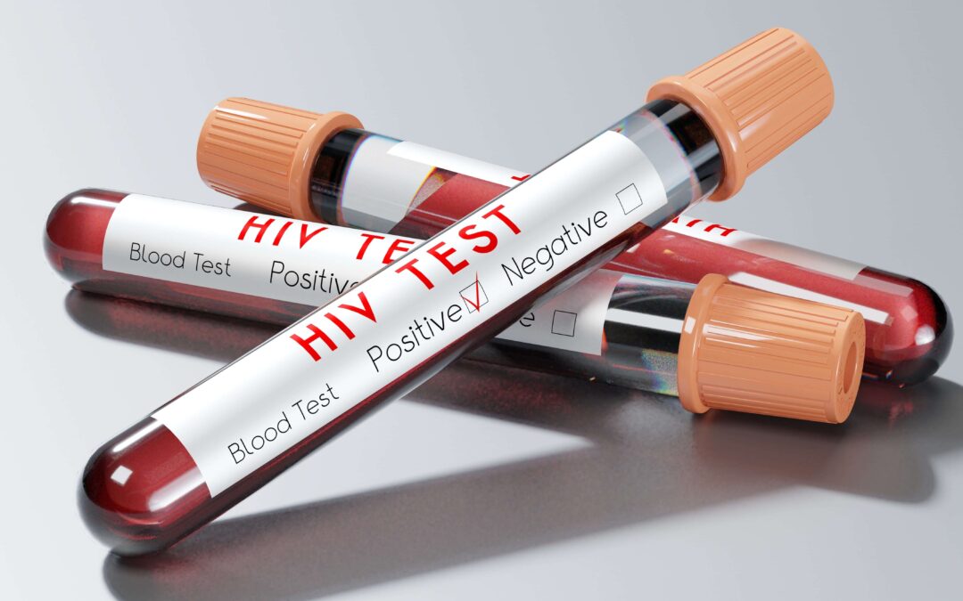 Test tubes filled with blood and marked as HIV-positive.