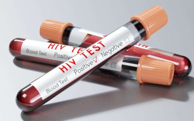 Term Life Insurance For HIV-Positive Individuals